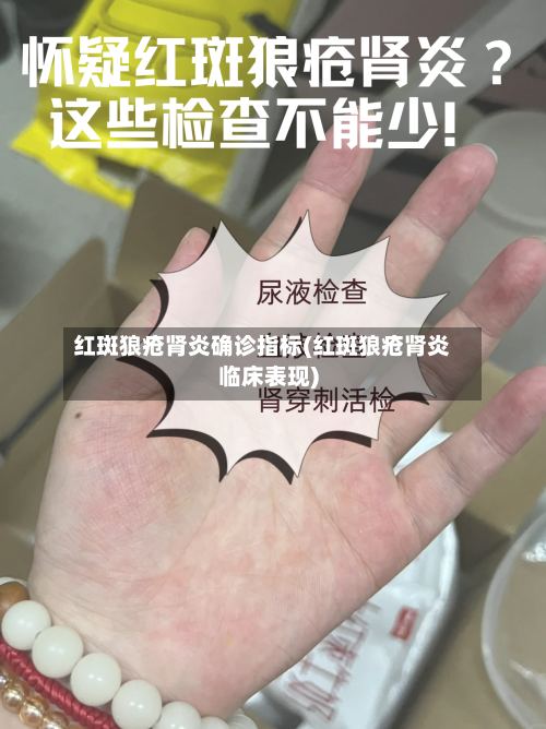红斑狼疮肾炎确诊指标(红斑狼疮肾炎临床表现)-第2张图片