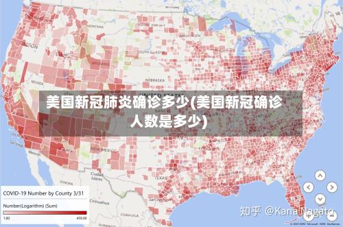 美国新冠肺炎确诊多少(美国新冠确诊人数是多少)-第2张图片