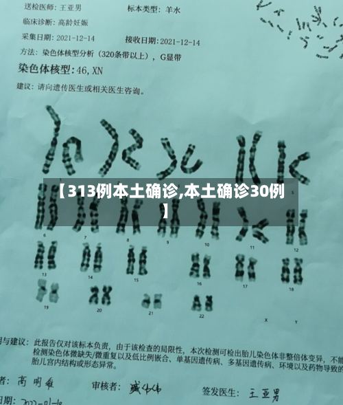 【313例本土确诊,本土确诊30例】-第3张图片