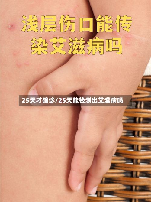 25天才确诊/25天能检测出艾滋病吗-第3张图片