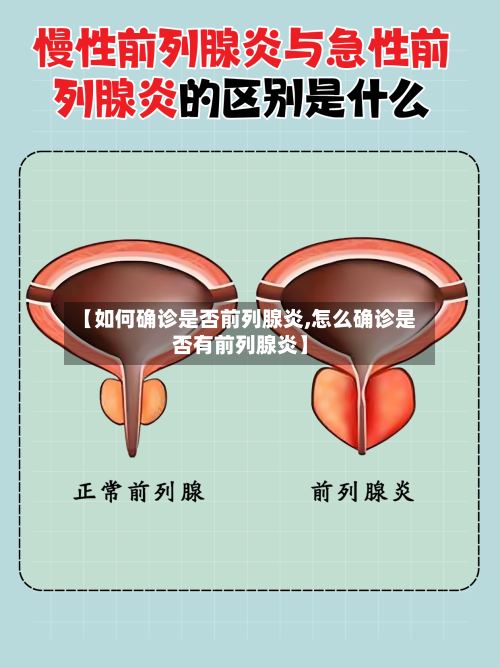 【如何确诊是否前列腺炎,怎么确诊是否有前列腺炎】-第3张图片