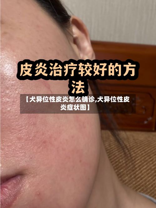 【犬异位性皮炎怎么确诊,犬异位性皮炎症状图】-第2张图片