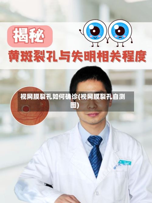 视网膜裂孔如何确诊(视网膜裂孔自测图)