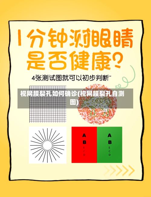视网膜裂孔如何确诊(视网膜裂孔自测图)-第2张图片