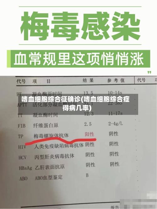 嗜血细胞综合征确诊(嗜血细胞综合症得病几率)