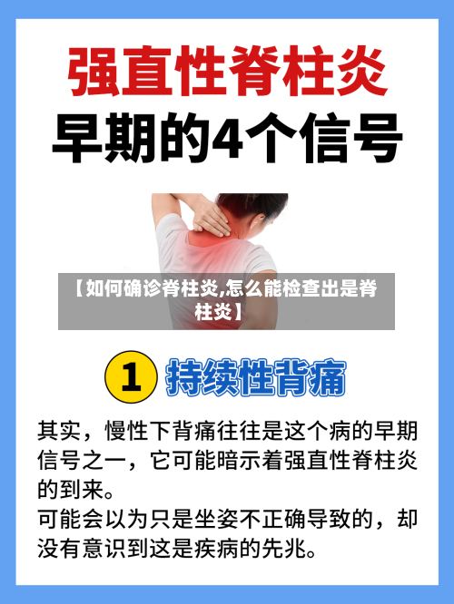 【如何确诊脊柱炎,怎么能检查出是脊柱炎】-第2张图片