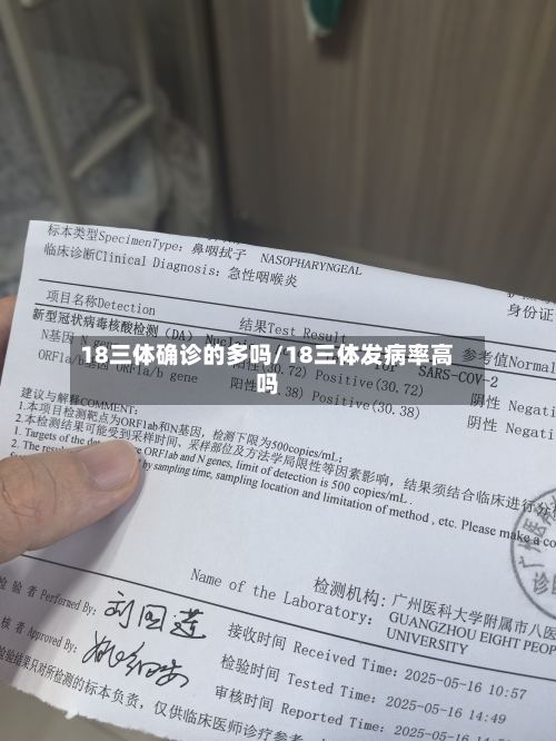 18三体确诊的多吗/18三体发病率高吗