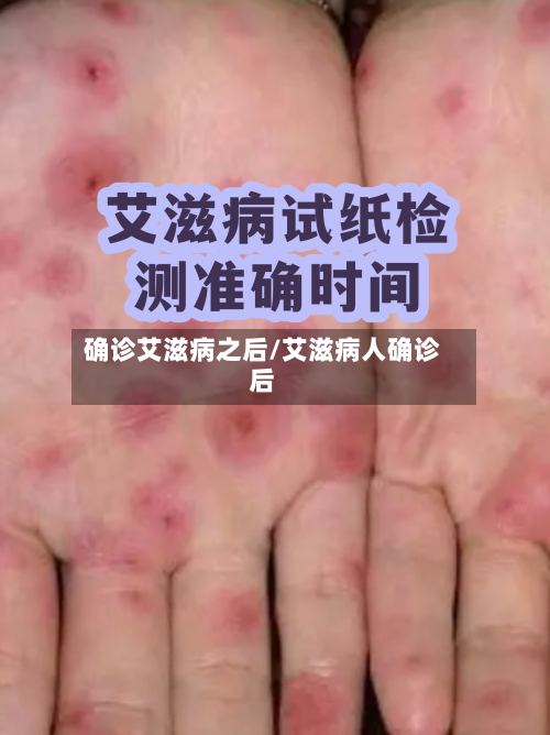 确诊艾滋病之后/艾滋病人确诊后-第2张图片