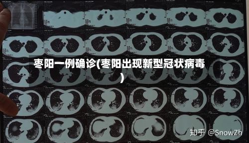 枣阳一例确诊(枣阳出现新型冠状病毒)