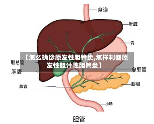 【怎么确诊原发性胆管炎,怎样判断原发性胆汁性胆管炎】
