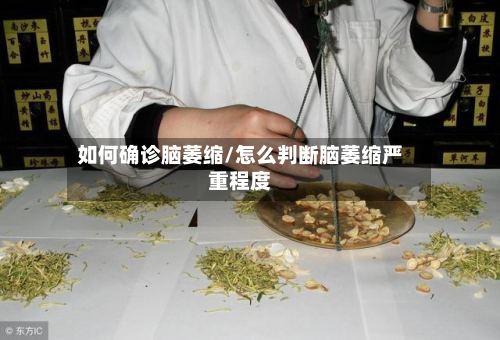 如何确诊脑萎缩/怎么判断脑萎缩严重程度-第3张图片