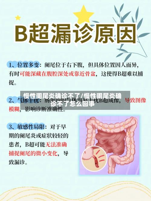 慢性阑尾炎确诊不了/慢性阑尾炎确诊不了怎么回事