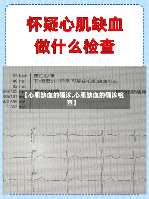 【心肌缺血的确诊,心肌缺血的确诊检查】-第3张图片