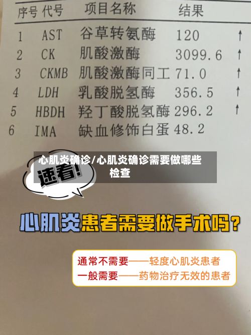 心肌炎确诊/心肌炎确诊需要做哪些检查-第2张图片