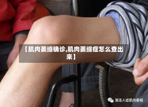 【肌肉萎缩确诊,肌肉萎缩症怎么查出来】-第2张图片