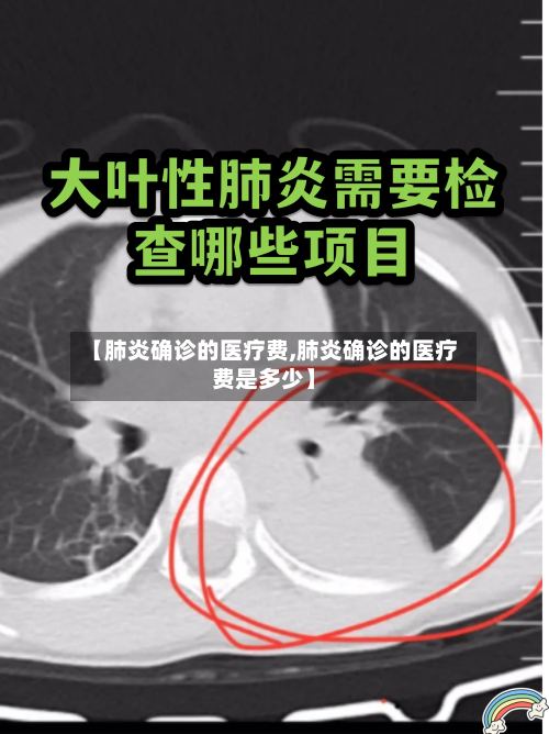 【肺炎确诊的医疗费,肺炎确诊的医疗费是多少】-第2张图片