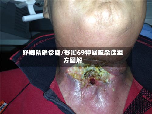 舒卿精确诊断/舒卿69种疑难杂症组方图解-第3张图片
