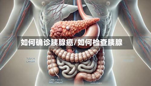如何确诊胰腺癌/如何检查胰腺-第2张图片