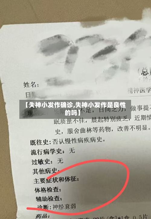 【失神小发作确诊,失神小发作是良性的吗】-第2张图片