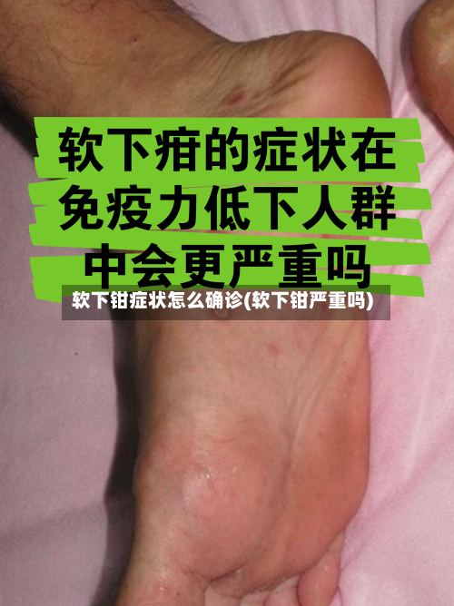 软下钳症状怎么确诊(软下钳严重吗)