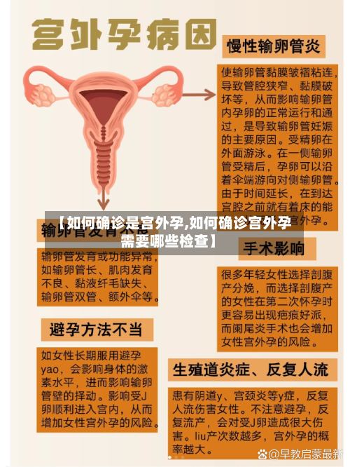 【如何确诊是宫外孕,如何确诊宫外孕需要哪些检查】