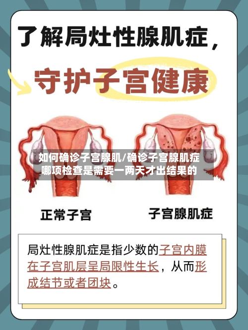 如何确诊子宫腺肌/确诊子宫腺肌症哪项检查是需要一两天才出结果的