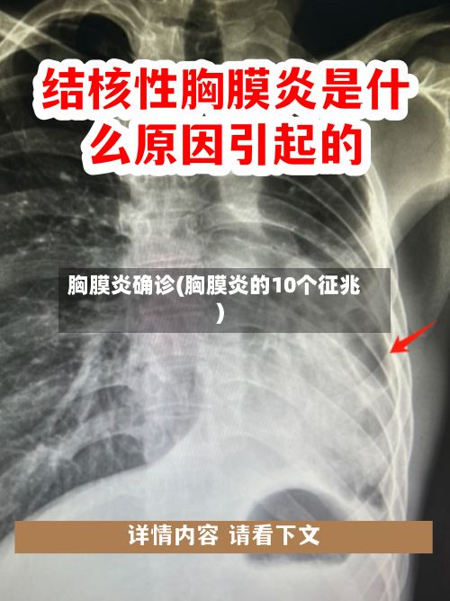 胸膜炎确诊(胸膜炎的10个征兆)-第3张图片