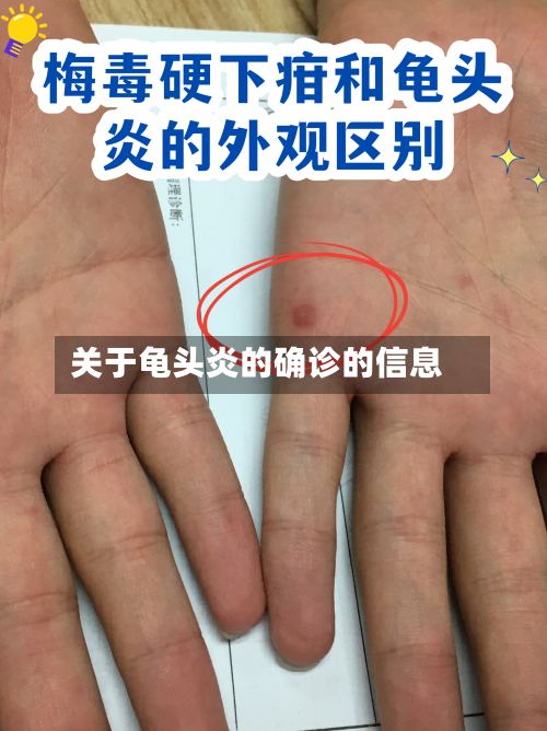 关于龟头炎的确诊的信息