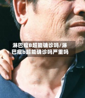 淋巴瘤B超能确诊吗/淋巴瘤b超能确诊吗严重吗-第2张图片