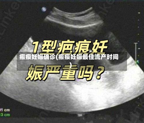 瘢痕妊娠确诊(瘢痕妊娠最佳流产时间)